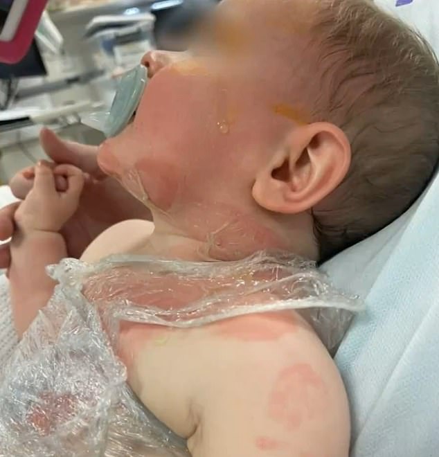 The nine-month-old baby boy (pictured) was attacked in a Brisbane park on Tuesday