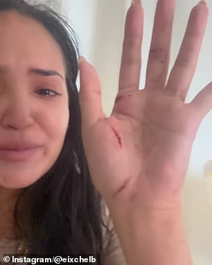 “There are no words to describe the terror, pain, trauma, fear and panic attacks this has caused us,” Berroteran wrote on Instagram under photos of her injuries