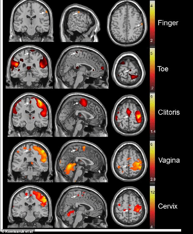 This 2011 paper by Barry R Komisaruk, a psychologist at Rutgers, showed how different types of stimulation affect different brain areas in women. Studies show a similar response in men,