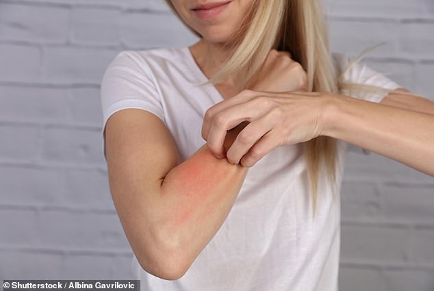 Drug rashes - also known as serious cutaneous adverse drug reactions (cADRs) - are rare but life-threatening delayed reactions to certain medications