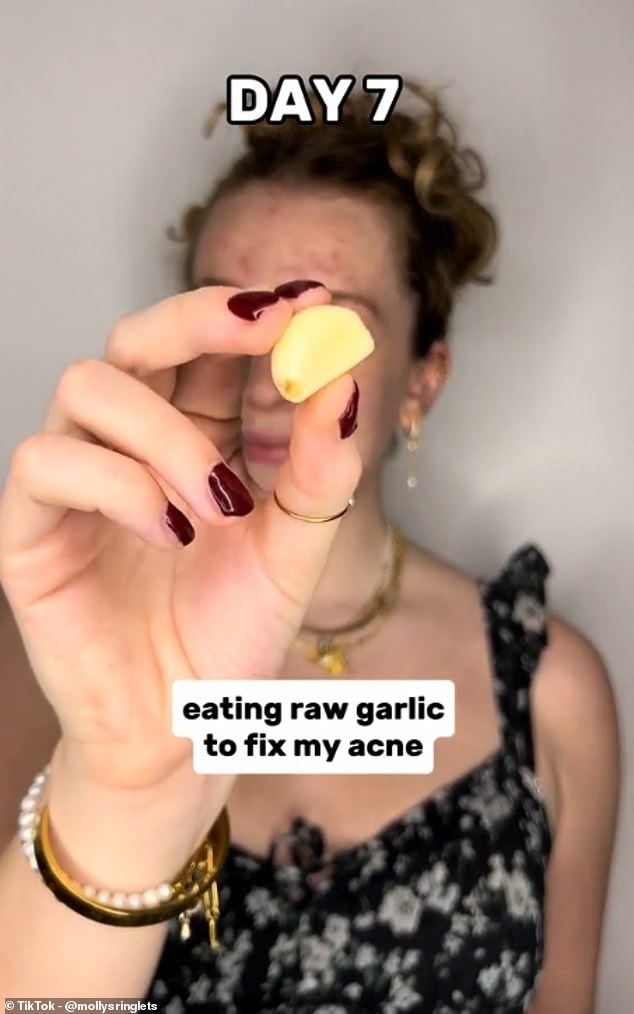 According to the latest TikTok skincare trick, one of the best ways to get rid of a pimple in no time is to chew on raw garlic or rub a garlic clove on your face.