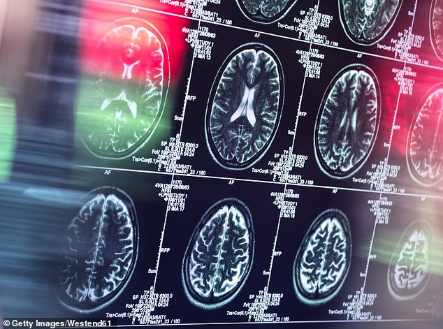 Early in Alzheimer's disease, cells that supply energy to neurons stop working as efficiently as they would in a normal brain. The researchers focused on this breakdown