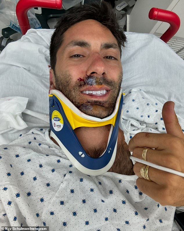 Catfish star Nev Schulman broke his neck in a terrifying accident that saw his motorcycle collide with a truck