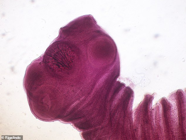 The species of tapeworm responsible for this is called Taenia solium (pictured) and can infect humans through contaminated feces and pork products