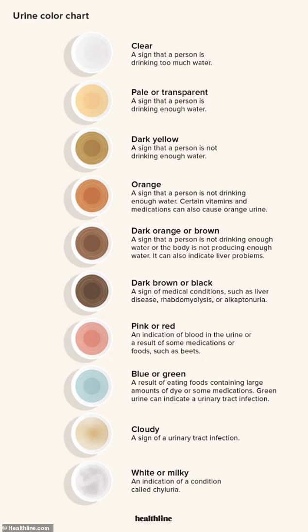 This graph illustrates what the color of urine tells us about what is happening in our bodies.