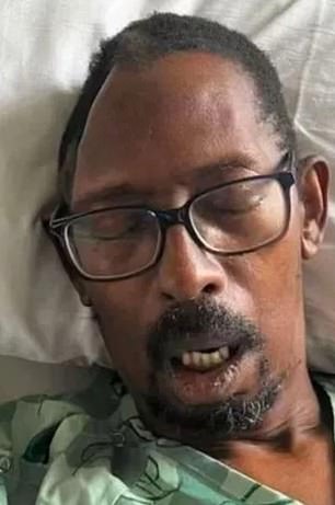 Fernando Cluster, 62, was admitted to Emory University Hospital Midtown in Atlanta in September 2022 for an intracerebral hemorrhage, during which the hospital reportedly lost a piece of his skull