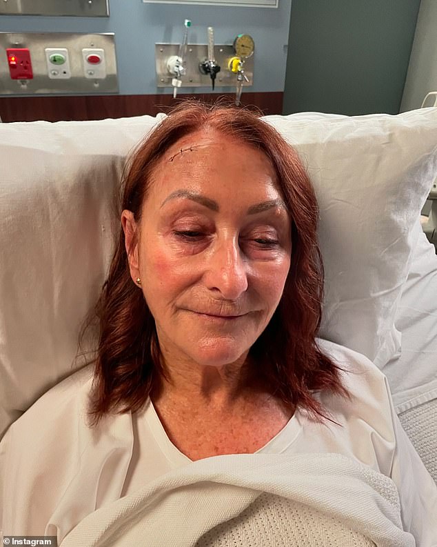 Lynne McGranger (pictured) has caused a stir after sharing photos of her bloody injuries