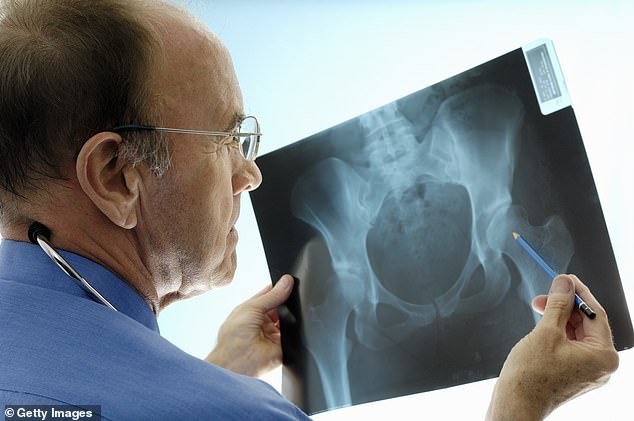 It could take decades to make up for the roughly 160,000 joint replacement surgeries lost since the pandemic, experts have found (file image)