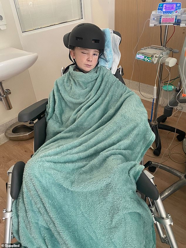 The teenager faces a long road to recovery and must wear a helmet to protect the 'soft' part of his head where his skull was removed.