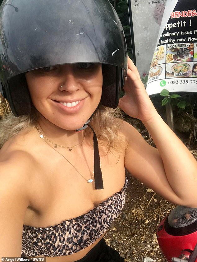 Angel Willows, 28, (pictured) was riding a moped in Bali, Indonesia, with her cousin when they crashed after hitting a pothole