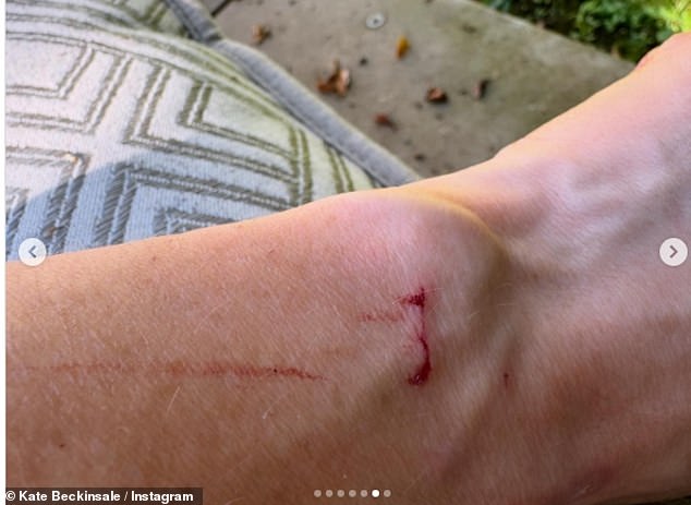 The actress showed her million followers a piece of her bloody skin, which had apparently been nibbled by the cat