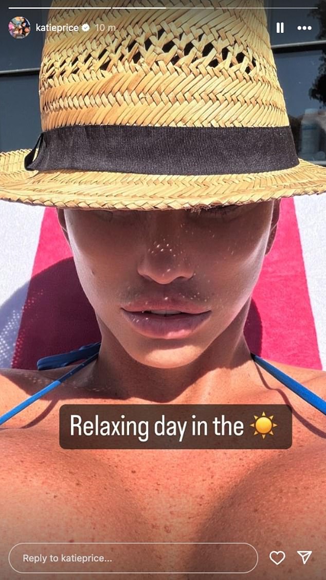 Katie Price showed off the results of her latest facelift after removing her bandages while sunbathing on Sunday.