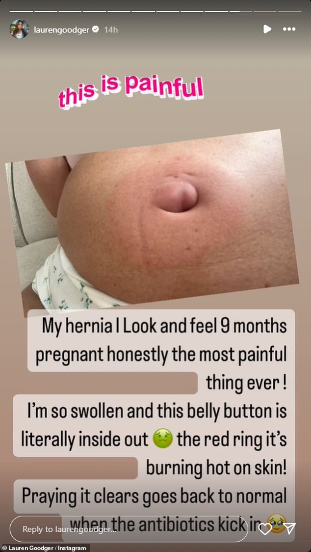 Lauren uploaded a photo of her painful belly and shared: 'My hernia. I look and feel like I'm 9 months pregnant, honestly it's the most painful thing ever!'