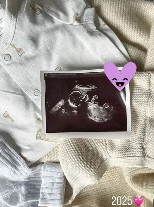 A fake Instagram account of Milla Corfixen, the Danish woman who allegedly cheated on Tommy Fury with Molly-Mae Hague, has posted a photo of an ultrasound