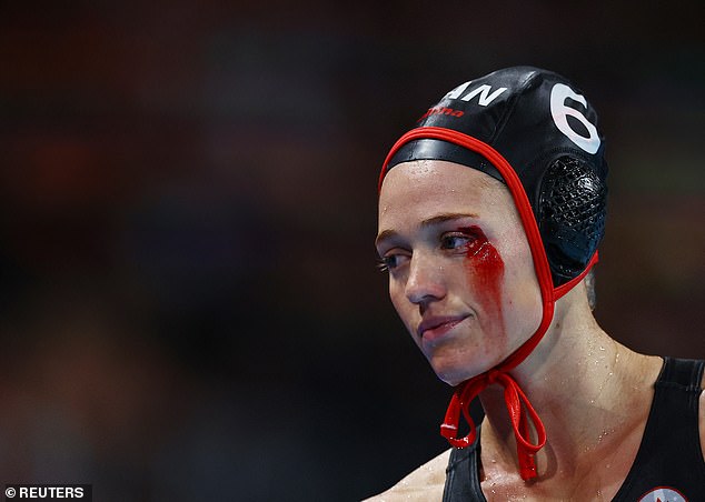 Canadian water polo player Blaire McDowell bled during their match against Canada