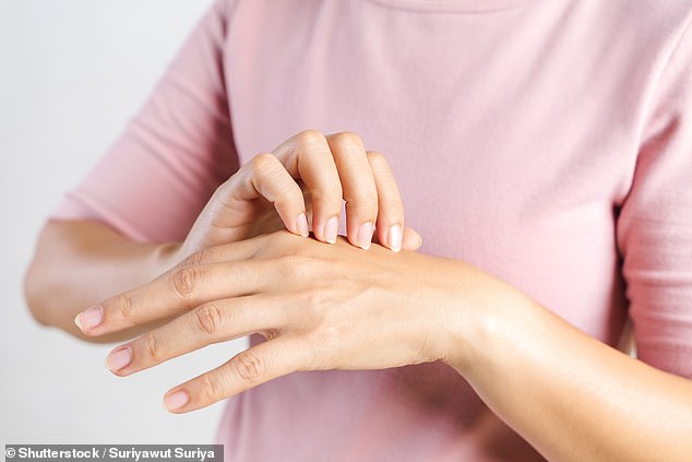 Hand eczema, in which the skin on the hands and wrists becomes wet, cracked and sore, is most common in people who work with irritating chemicals.