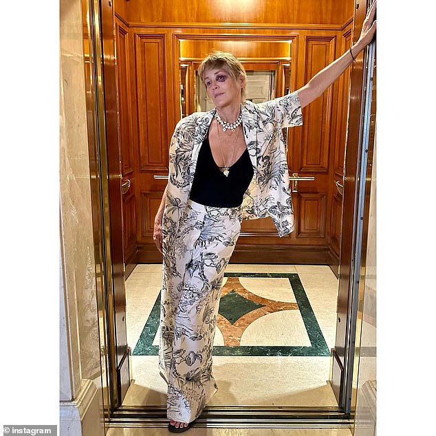 Sharon Stone showed off a black eye in a photo that went viral on social media on Wednesday. The blonde Oscar nominee traveled all over Europe this summer - she was in Cannes, Rome and Turkey