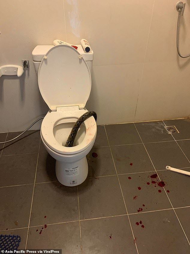 Disturbing photos show blood in Thanat's bathroom after he was bitten on his testicles