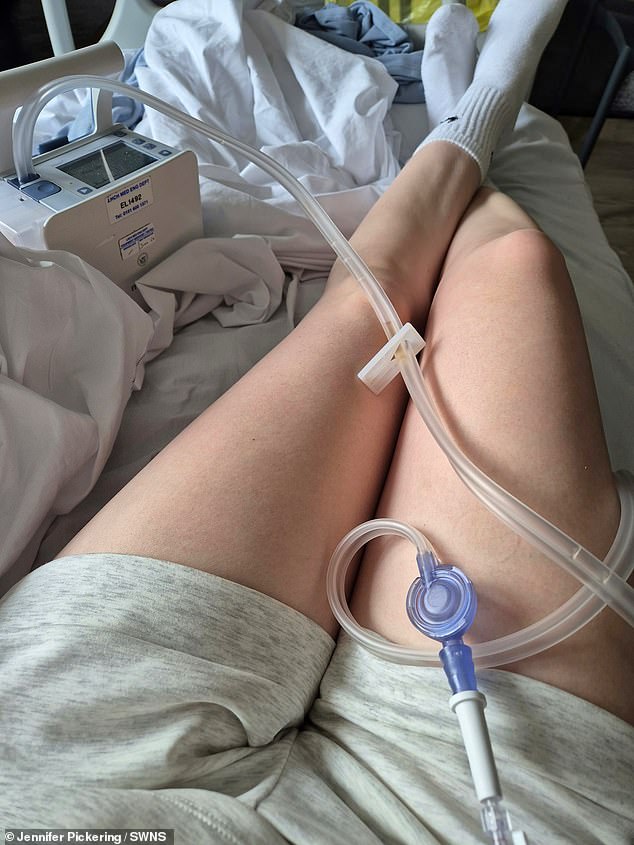 In November, she was referred for video-assisted thoracoscopic surgery (VATS) - which involves inserting a small camera and surgical instruments into the chest - to treat her collapsed lung, and spent 'months' in recovery