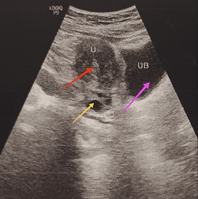 Despite the woman's genitals looking male, scans showed her female reproductive organs were intact. Image: Springer Nature