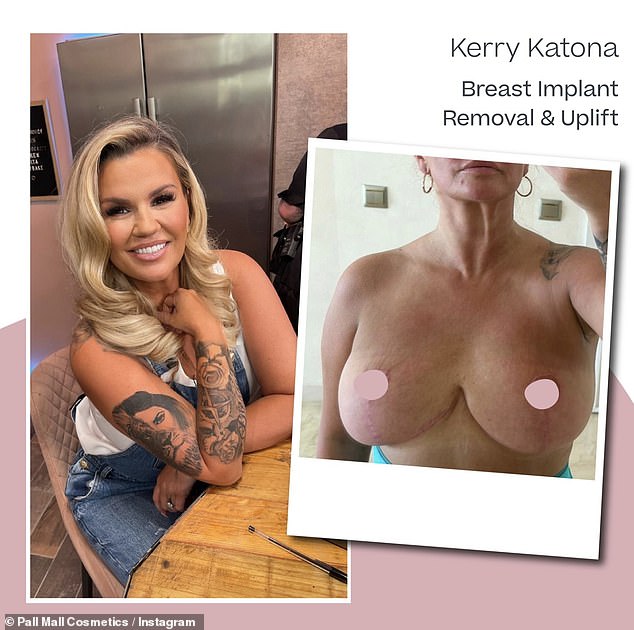 In 2022, Kerry went braless revealing the results of her third breast reduction, after previously admitting she regretted getting a free boob job