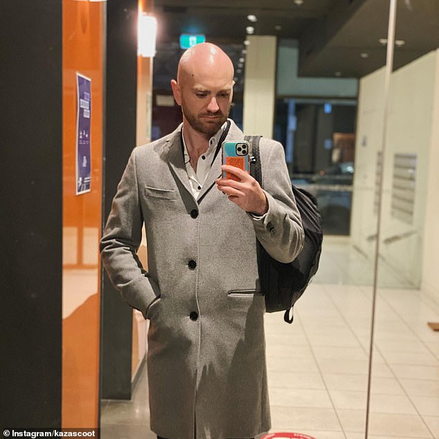 The aspiring actor said he was forced to shave his head in recent years because the hair on top had become unbearably thin, despite his young age.