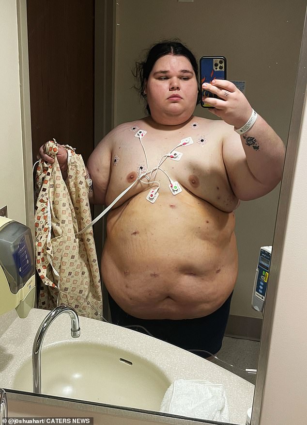 Joshua Hart, who weighs 427 pounds, was constantly mistaken for a woman because of the excess fat around his chest, which made it appear as if he had breasts