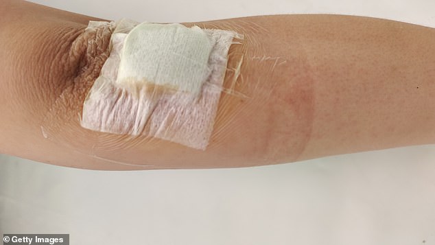 Chronic wounds are common in conditions such as diabetes due to poor blood circulation (file image)