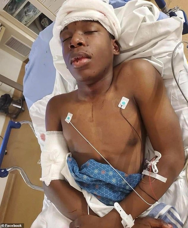 Ralph Yarl, now 17, was shot by Lester on April 13, 2023, after going to the wrong address when he went to pick up his younger twin brothers from their friend's house in Kansas City, Missouri (pictured: Yarl in the hospital after the shooting)