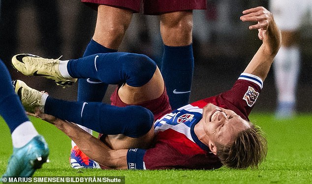 Arsenal unsure how long Martin Odegaard will be out after injury against Norway