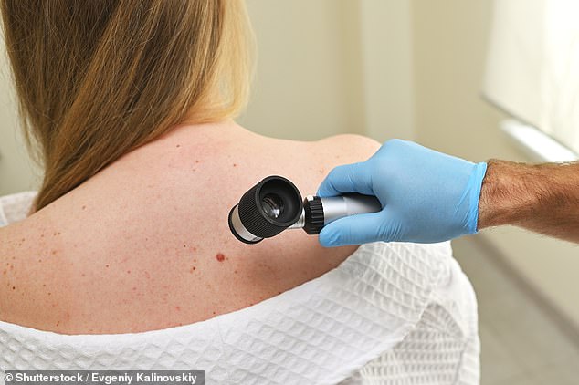 Basal cell carcinoma is one of the most common forms of skin cancer. It is highly curable, especially if detected early. It is a slow-growing cancer that is usually confined to the surface of the skin. Doctors often remove it through a shallow incision