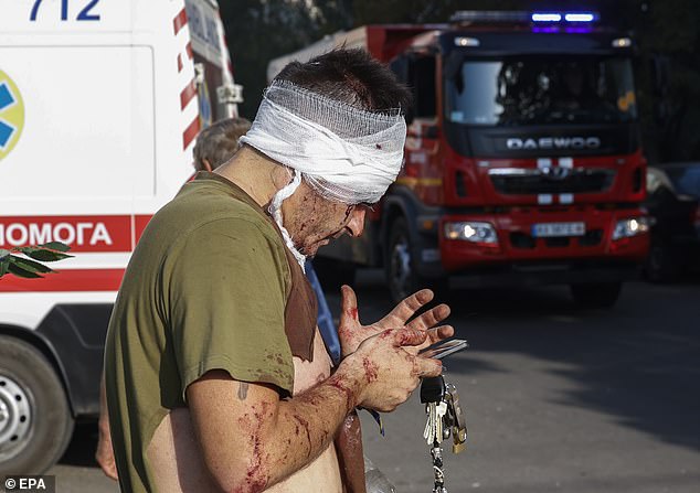 An injured local man tries to send a message on a mobile phone at the site of a damaged residential building after a shelling in Kharkiv