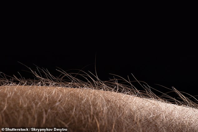 These fibers, also called C fibers, are found in the skin where hair grows, as they have connections to hair follicles. (Stock photo)