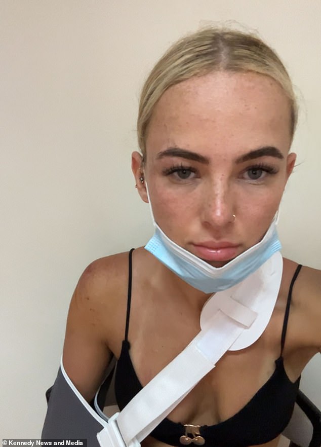 Maddy shared a video of the severity of her injuries as a warning to other holidaymakers