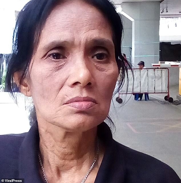 Arrom (pictured) was washing dishes in her outdoor kitchen in Samut Prakan, Thailand, when she suddenly felt a shooting pain in her right thigh