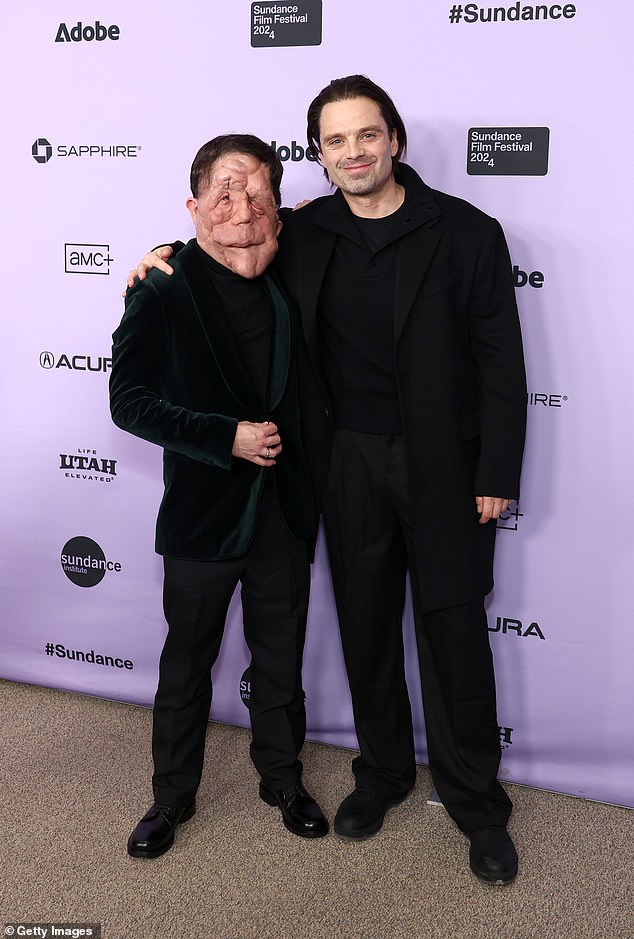 At Sundance, Pearson revealed that he encouraged Stan to appear in public with his prosthetics to get a feel for what it's like to live with a disfigurement; they're set to debut in January