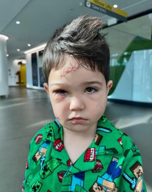 The boy will need more treatment for his serious injuries in the coming week, his mother said