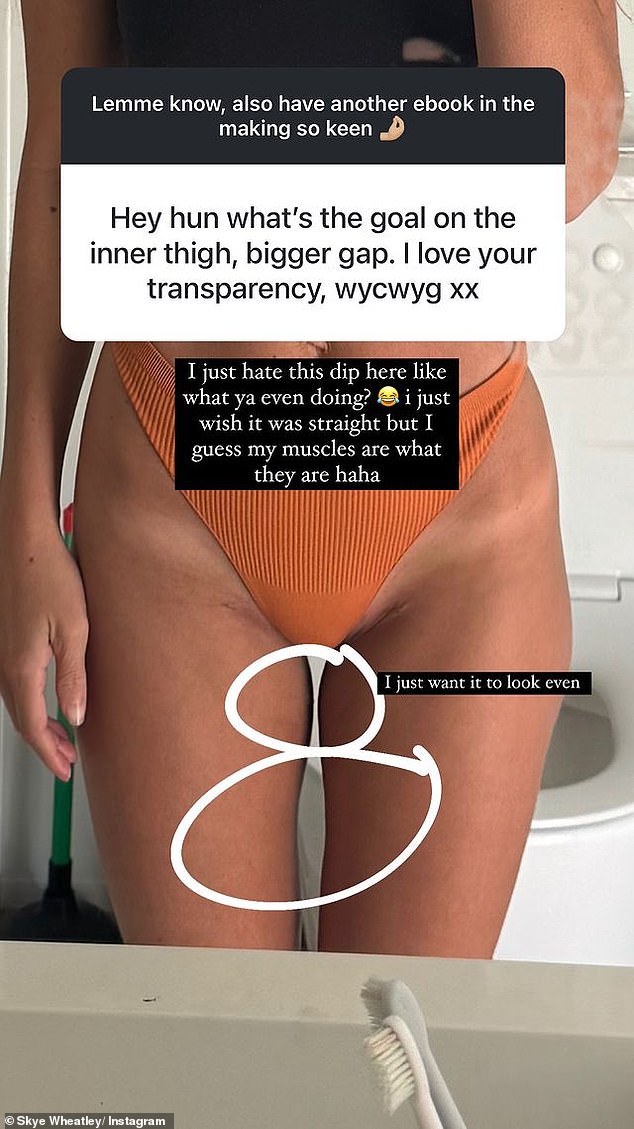 Skye, who has been candid about the work she's had done, responded to a Q&A about her thighs