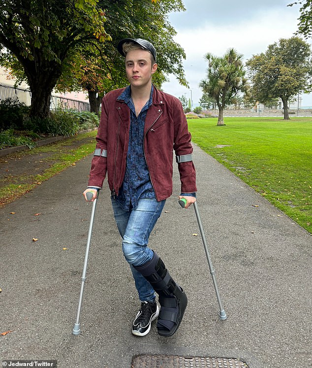 Alongside photos of him wearing his foot in a medical boot and using crutches, he shared: 'It's broken, I'm devastated my ankle gave out last night after all these years of performing!'