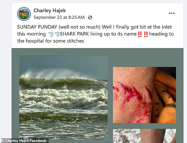 Hajek posted a message on Facebook documenting the incident before driving to the hospital, demonstrating his relaxed demeanor