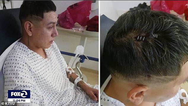 Cruz said he had to have staples put in his head after the random attack