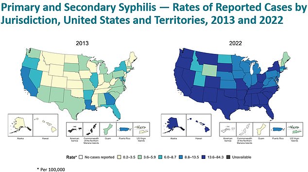 The two maps show how the number of syphilis cases in the US has changed since 2013