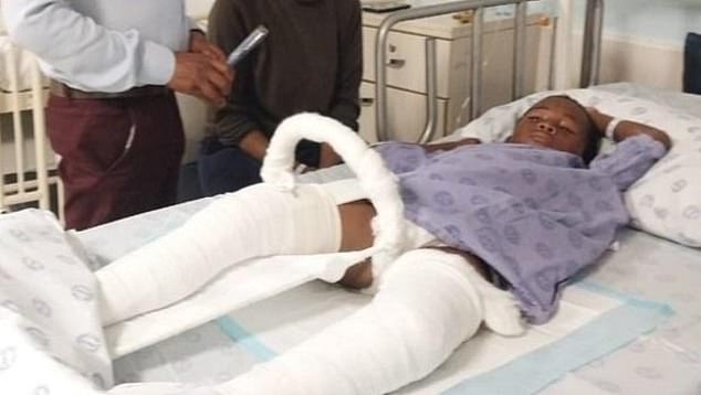 Khwezi had both legs broken after allegedly stealing an orange from Stoman's farm in Lutzville, in Vredendal, South Africa