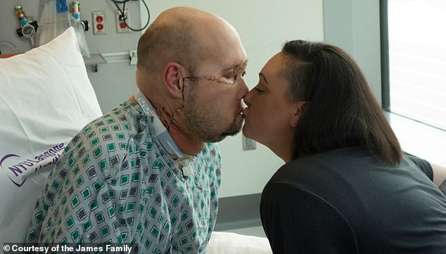 Mr. James (pictured with his wife Meagan) spent just 17 days in intensive care. The two were able to kiss for the first time since the transplant