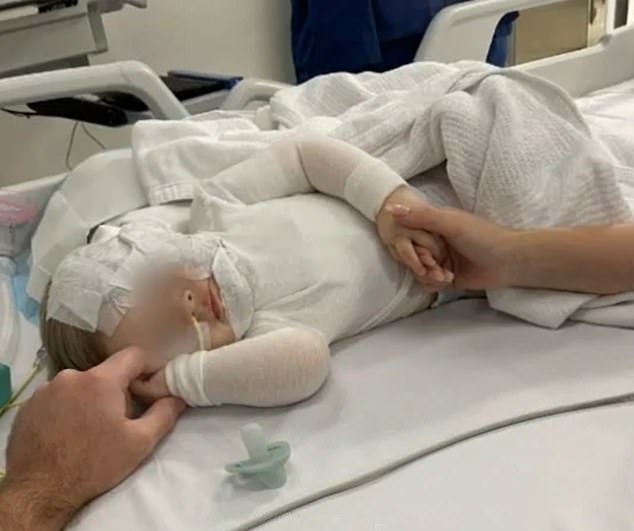 Nine-month-old baby Luka (pictured) suffered life-threatening burns to his face, upper body and arms after a stranger poured hot coffee over him