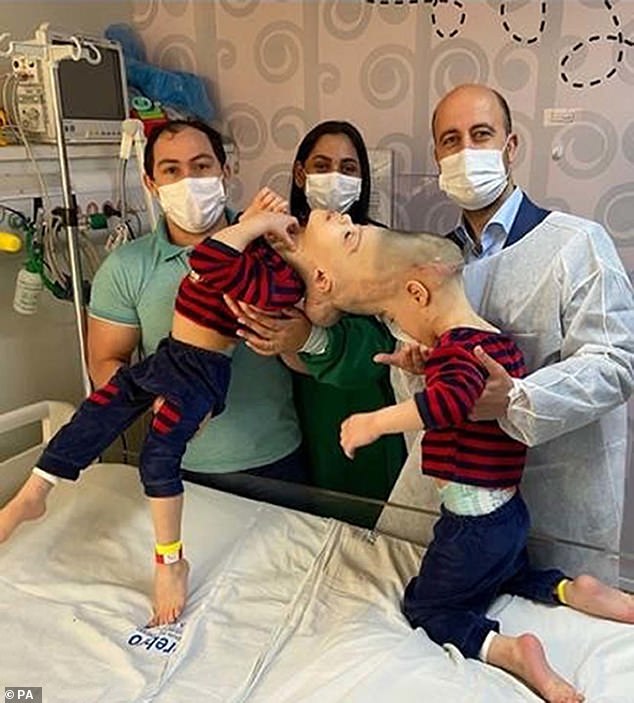 Dr. Jeelani previously performed surgery to separate Bernardo and Arthur Lima, who were born with fused brains. The twins underwent multiple surgeries in Rio de Janeiro, under Dr. Jeelani’s supervision. Pictured: The twins before the procedure with surgeon Dr. Noor ul Owase Jeelani (right) and their parents Adriely and Antonia Lima (left)