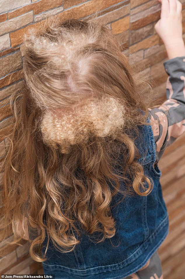 The tourism engineer shared clips of her daughter's locks on TikTok to raise awareness, with one video receiving 1.4 million views and more than 32,000 likes