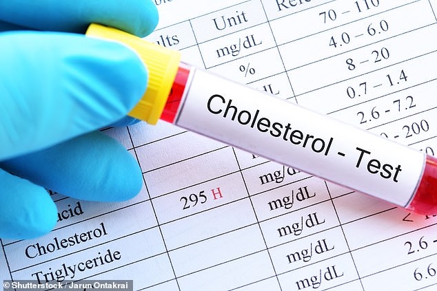 Almost any artery can be affected by cholesterol, writes Dr. Martin Scurr