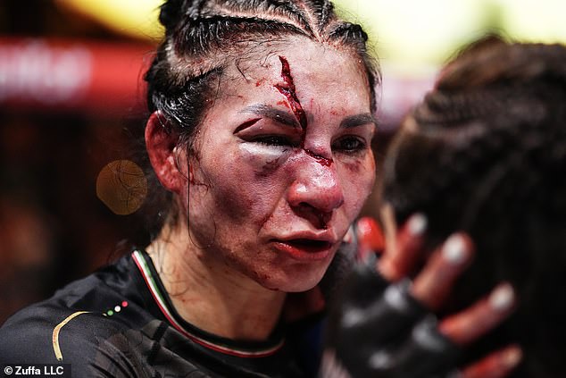 Bantamweight Irene Aldana suffered a large deep cut to her face during her fight against Norma Dumont