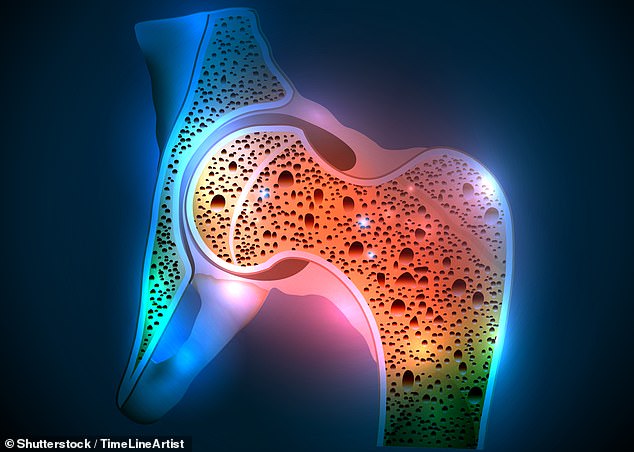 According to NICE, more than 2 million women in England and Wales have osteoporosis. The condition, which develops slowly over many years, weakens bones, making them more likely to break, the NHS says.